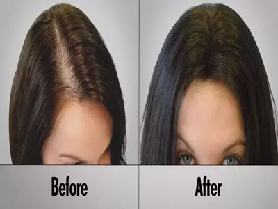 Indian Hair Fixing Center Aligarh